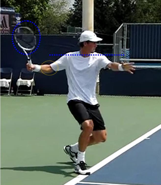 Berdych 1